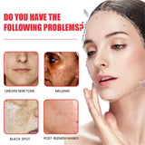Dark Spots Remover Whitening Serum Face Freckle Melanin Correcting Reduce Fine Lines Brighten Essence Korean Beauty Skin Care