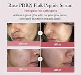 Niacinamide Dark Spot Remove Serum Face Freckle Melanin Correcting Moisturizing Brightening Anti Pigmentation Repair Skin Care