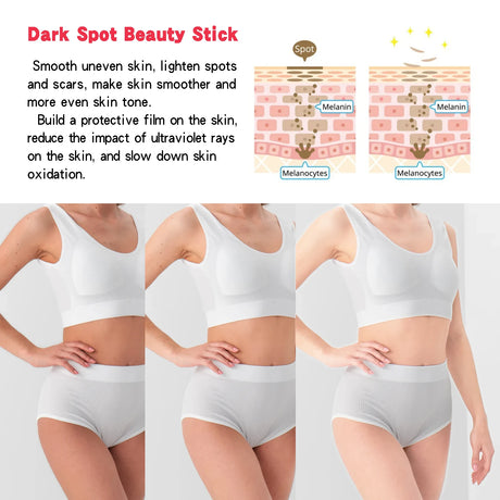 Lightening Body Cream Remove Dark Spots Melanin Bleaching Elbow Armpit Leg Knee Hips Thigh Moisturizing Whitening Underarm Stick