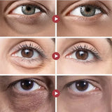 Anti Dark Circle Eye Serum Oil Retinol Anti Wrinkle Firming Lift Skin Remove Eyes Bag Fade Fine Line Whitening Brighten Eye Care