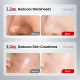 NING DERMOLOGIE Amino Acid Korean Facial Cleanser with Salicylic Acid Help with Pore Tighten, Acne & Blackheads