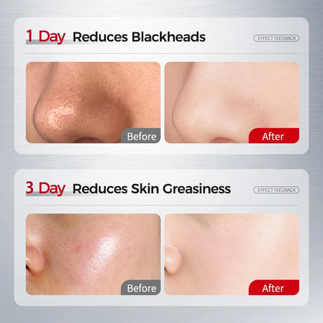 NING DERMOLOGIE Amino Acid Korean Facial Cleanser with Salicylic Acid Help with Pore Tighten, Acne & Blackheads