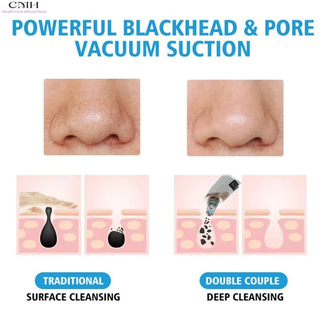 CMH Blackhead Remover Vacuum Pore Cleaner Multi Suction Heads Adjustable Suction USB Rechargeable Deep Cleansing Skin Tool Gifts
