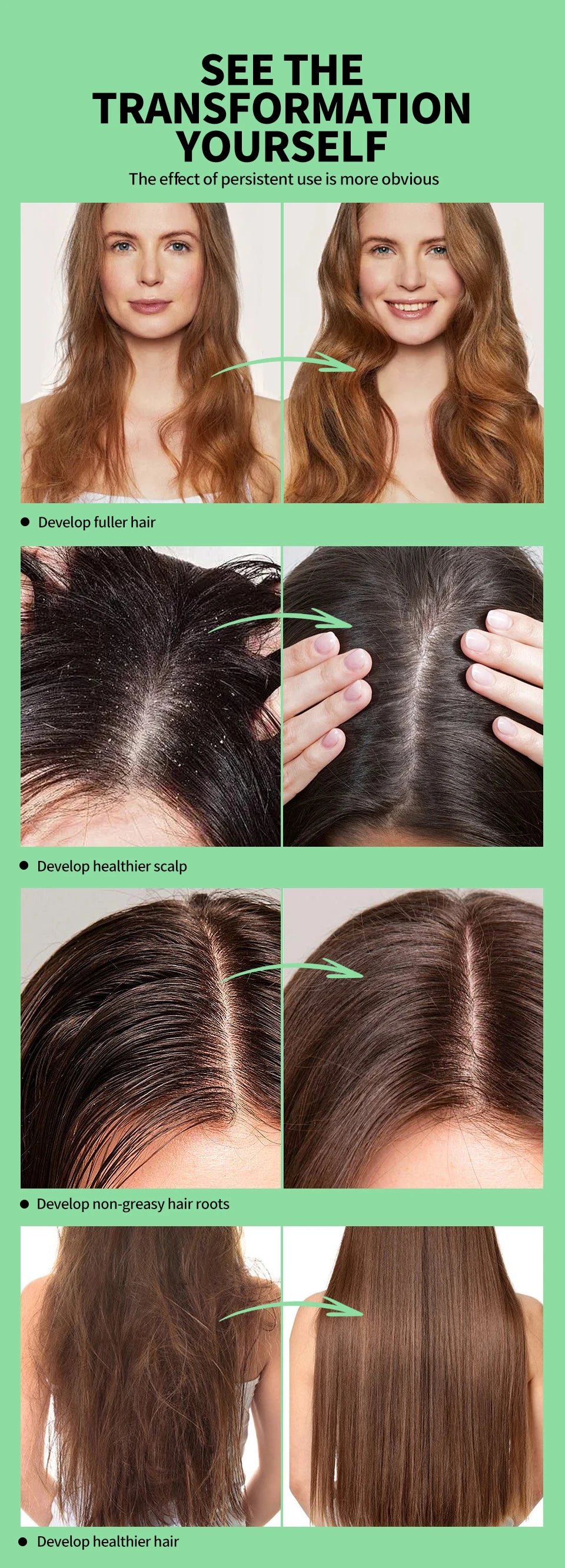 Tea Tree Essence Shampoo Hair Conditioner Set Deep Cleaning Moisturizing Scalp Strengthening Nourish Shiny Anti Hair Loss Care
