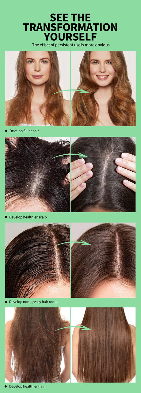 Tea Tree Essence Shampoo Hair Conditioner Set Deep Cleaning Moisturizing Scalp Strengthening Nourish Shiny Anti Hair Loss Care