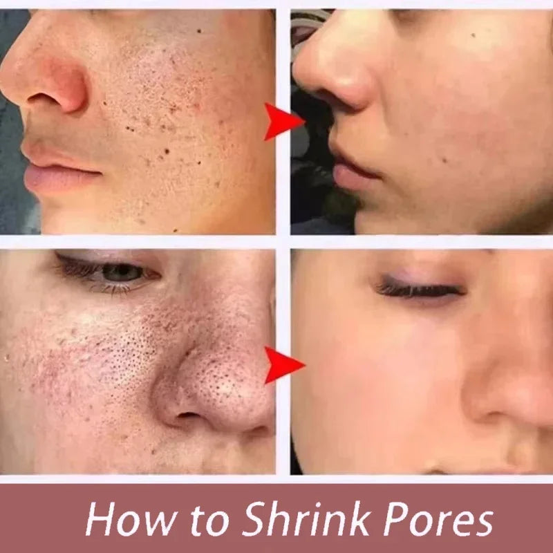Remove Large Pores Serum Salicylic Acid Facial Pore Shrinking Tightening Pore Minimizing Firming Smooth Essence Korean Skin Care