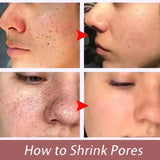 Remove Large Pores Serum Salicylic Acid Facial Pore Shrinking Tightening Pore Minimizing Firming Smooth Essence Korean Skin Care