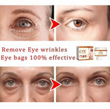9selling wrinkle removing eye cream, eye bags, dark circles, anti swelling, firming, brightening, fine lines, moisturizing tool