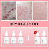 Salmon PDRN Collagen Peptide Facial Serum for Dull Skin - Boosts Elasticity Skin Renewal Repair Korean Beauty Product