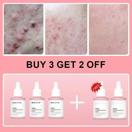 Salmon PDRN Collagen Peptide Facial Serum for Dull Skin - Boosts Elasticity Skin Renewal Repair Korean Beauty Product