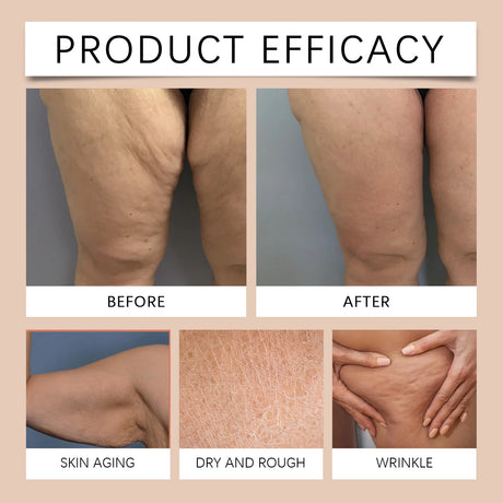Moisturizing Anti Cellulite  Firming Body Oil Sagging Skin Tightening Anti-Aging for Body Refreshing Hydrate Firming Body Oil