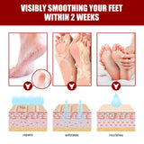 Exfoliating Feet Mask Sock Exfoliation Scrub for Feet Mask Remove Dead Skin Moisturizing Pedicure Anti Crack Foot Patch Spa 5PCS