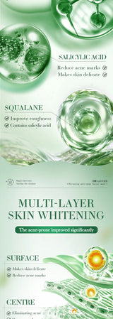 SADOER Salicylic Acid Nicotinamide Whitening Face Serum Acne Removing Moisturizing Anti Wrinkles Facial Essence Skin Care