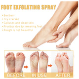 Ouhoe Foot Exfoliating Spray 72H Moisture Lock Callus Softener Anti Dry Crack Repair Odor Control Brightening Foot Care Liquid