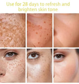 Powerful Dark Spots Remover Freckle Whitening Serum Melanin Correcting Anti Pigmentation Brighten Korean Day Night Facial Care