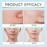 AHA BHA Toner Gentle Exfoliating Toner for Oily Skin Pore Refining Soothing Hydrating Facial Essence Daily Oil Control Skincare