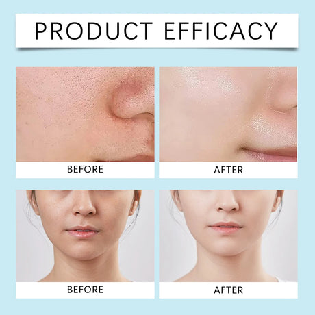 AHA BHA Toner Gentle Exfoliating Toner for Oily Skin Pore Refining Soothing Hydrating Facial Essence Daily Oil Control Skincare