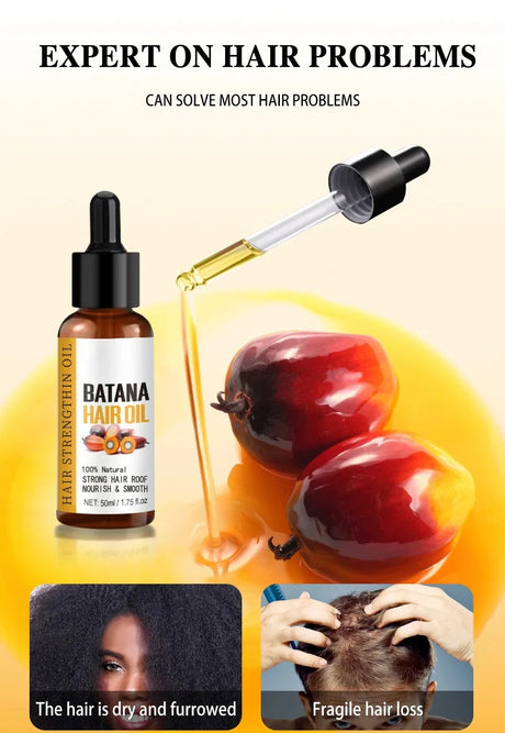 Batana Oil Hair Growth Products Fast Growth Batana Essence Oil Traction Alopecia Anti Hair Loss Baldness Treatment For Men Women