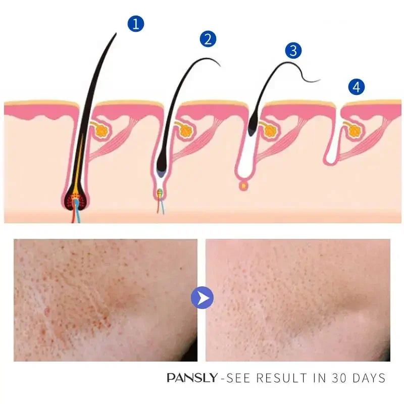 50g Hair Removal Cream for Unisex Reduce Hair Growth Removal Permanent Cream Beard Intimate Legs Body Armpit Painless Depilatory