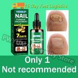 7 Days Nail Fungus Treatment Serum Ginger Anti-infective Paronychia Onychomycosis Toe Foot Nail Fungal Repair Gel Hand Foot Care
