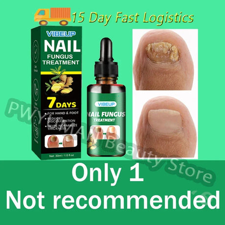 7 Days Nail Fungus Treatment Serum Ginger Anti-infective Paronychia Onychomycosis Toe Foot Nail Fungal Repair Gel Hand Foot Care