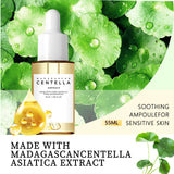 Centella Asiatica Soothing Serum 55ml - Madagascar Formula Calms Sensitive Skin, Supports Acne Care & Deeply Moisturizes.