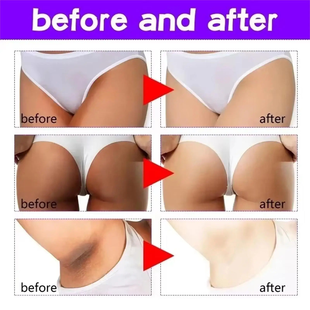 Body Whitening Cream Private Parts Bleach Arm Knees Lip Dark Skin Brighten Melanin Intimate Area Pink Essence Moisturizing Care