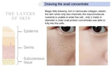 Remove Large Pores Serum Salicylic Acid Facial Pore Shrinking Tightening Pore Minimizing Firming Smooth Essence Korean Skin Care