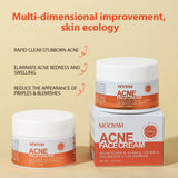 Herbal Acne Treatment Cream Anti Acne Face Cream Pimple Removal Spots Oil Control Shrink Pores Moisturizing Skin Care Cream