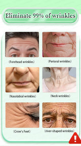 wrinkles disappeared