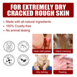 Exfoliating Feet Mask Sock Exfoliation Scrub for Feet Mask Remove Dead Skin Moisturizing Pedicure Anti Crack Foot Patch Spa 5PCS