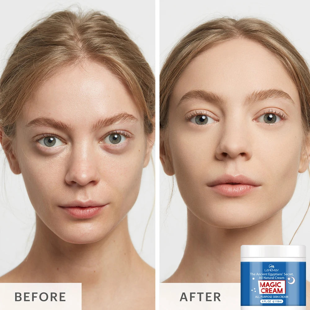 118ML Magic Face Cream: Moisturizing, Hydrating & Deep Nourishing Formula for All Skin Types
