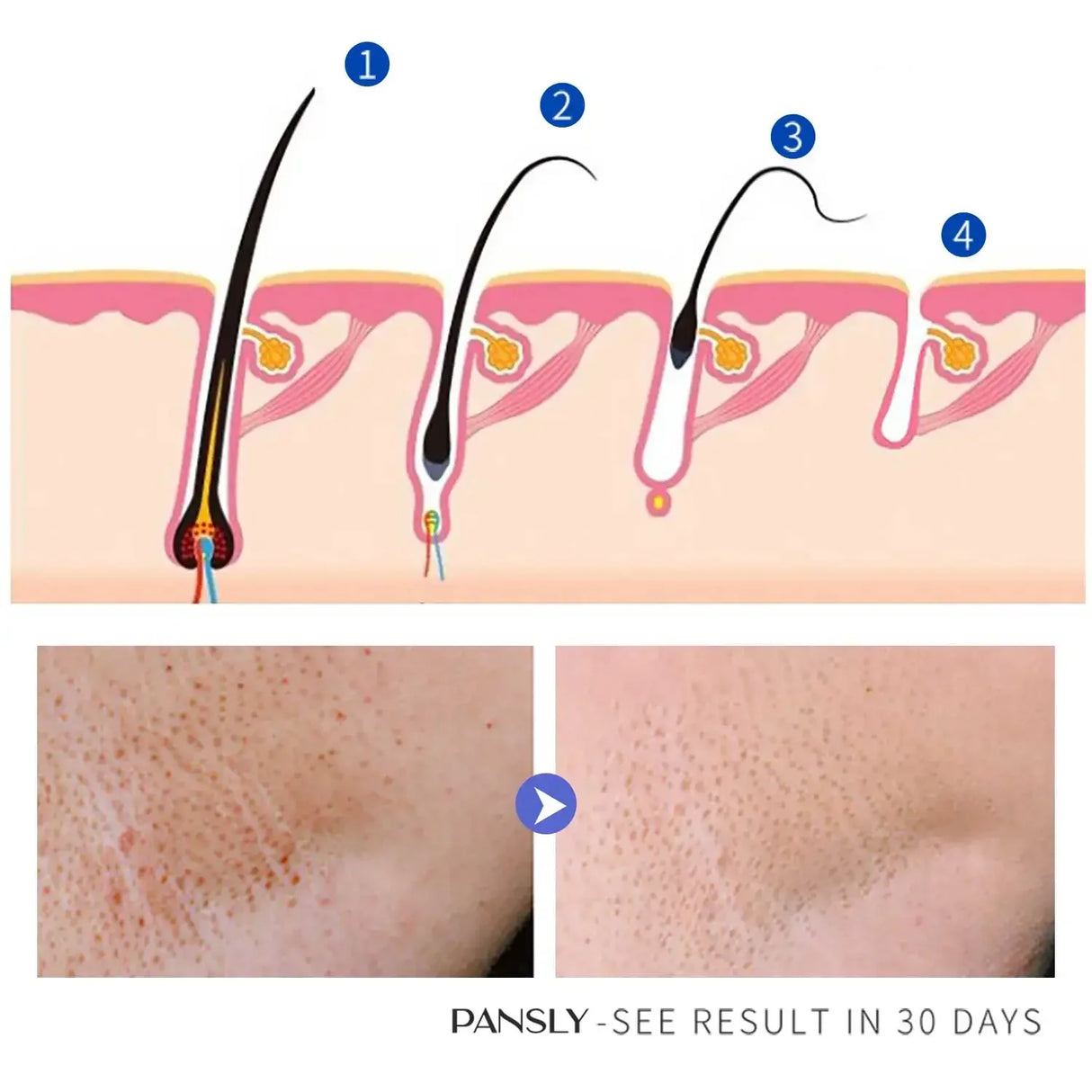 50g Hair Removal Cream for Unisex Reduce Hair Growth Removal Permanent Cream Beard Intimate Legs Body Armpit Painless Depilatory