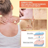 Body Whitening Soap Deep Skin Bleaching Brighten Body Scrub Knees Intimate Parts Armpits White Nourishing Care Soap
