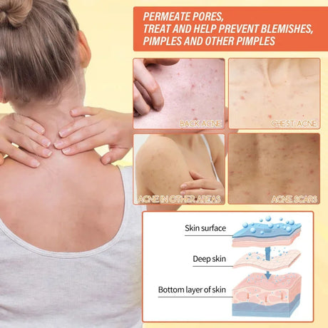 Body Whitening Soap Deep Skin Bleaching Brighten Body Scrub Knees Intimate Parts Armpits White Nourishing Care Soap