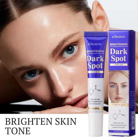 Dark Spots Removal Cream Facial Whitening Freckle Acne Mark Pigmentation Removal Melanin Skin Correction Brighten Care Products