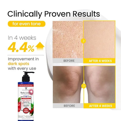 500ml Alpha Arbutin 30% AHA+2% BHA Whitening Body Lotion Glow Skin Brightening Moisturizer Hydrating Smoothing Body Cream