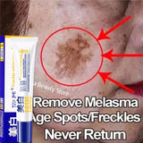 Powerful Spot-Removing Whiten Cream Brighten Skin Fast Eliminates Melanin Pigmentation Melasma Dark Spots Korean Face Skin Care