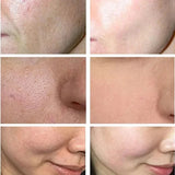 Salicylic Acid Pore Shrinking Cream Quick Elimination Large Pores Remove Blackehead Tighten Face Smooth Skin Korean Care Product