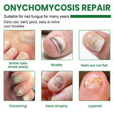 7 Days Nail Fungus Treatment Serum Ginger Anti-infective Paronychia Onychomycosis Toe Foot Nail Fungal Repair Gel Hand Foot Care