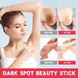 Lightening Body Cream Remove Dark Spots Melanin Bleaching Elbow Armpit Leg Knee Hips Thigh Moisturizing Whitening Underarm Stick