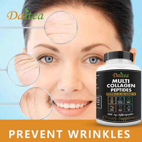 High Strength Multi-Collagen Complex Capsules – Hydrolyzed Peptides for Skin, Hair, Nails & Joints – Grass-Fed, Non-GMO