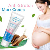 Snail Removes Stretch Mark Cream To Remove Postpartum Obesity Pregnant Women Repair Anti-Aging Anti-Winkles Firming Body Cream