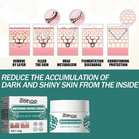 Whitening Freckle Cream Effectively reduces dark spots Brightens and revitalizes dull skin  Hydrates and nourishes the skin