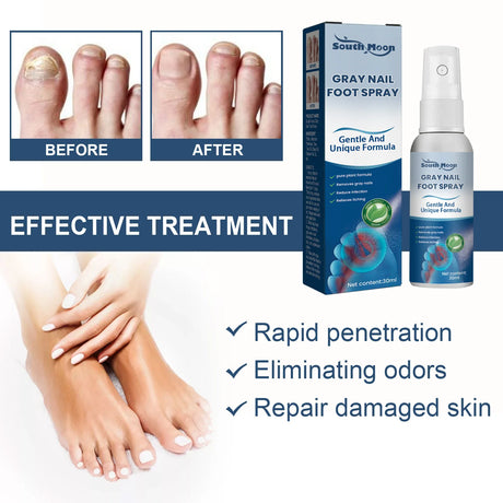 South Moon Foot Spray Anti Smell Remove Toenail Fungal Paronychia Onychomycosis Care Deodorant Antiperspirant Nail Repair Spray