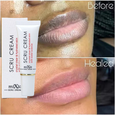 Remove Dark Lip Balm Fast Lightening Pink Lip Exfoliating Fade Lip Line Dead Skin Moisturizer Korean Care Products Beauty Health