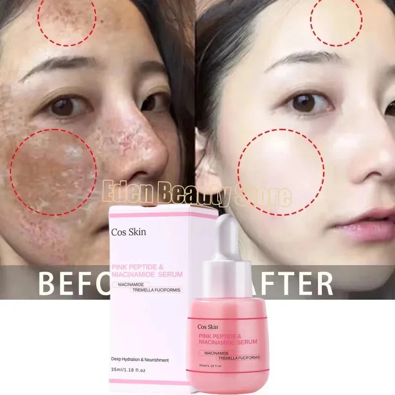 Niacinamide Dark Spot Remove Serum Face Freckle Melanin Correcting Moisturizing Brightening Anti Pigmentation Repair Skin Care