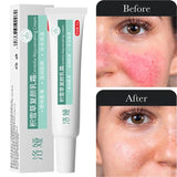 Instant Facial Redness Repair Cream Soothing Red Blood Rosacea Treatment Improve Sensitive Skin Anti Redness Skin Care Cosmetics