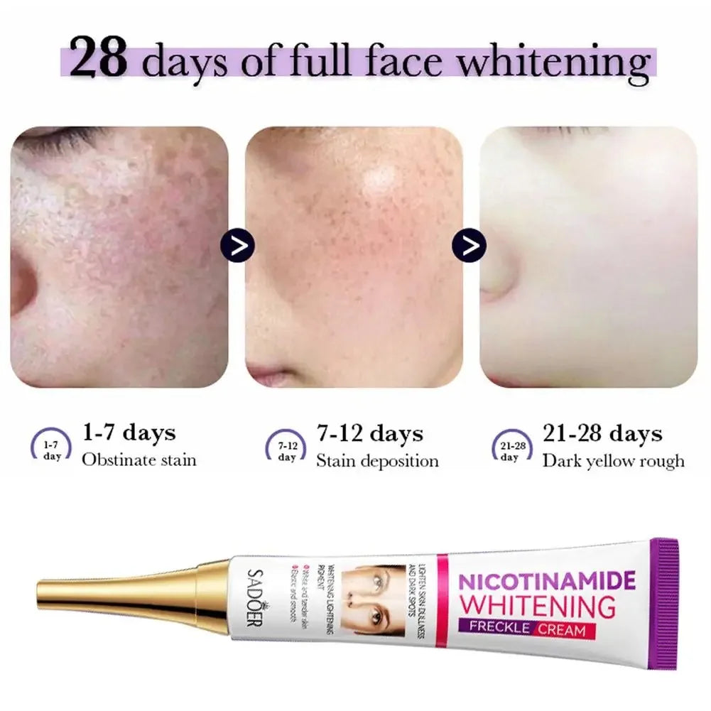 SADOER Nicotinamide Remove Melasma Dark Spot Whiten Freckle Cream Lighten Melanin Brightens Skin Tone Moisturize Face Skin Care