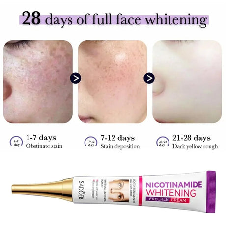 SADOER Nicotinamide Remove Melasma Dark Spot Whiten Freckle Cream Lighten Melanin Brightens Skin Tone Moisturize Face Skin Care
